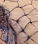 Blind, burned, bruised... she died alone